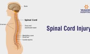 Modern Approaches to Preventing and Managing Spinal Cord Injuries